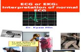 Interpretation of Normal ECG *medical