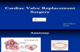 Cardiac Valve Replacement Surgery