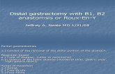 Distal Gastrectomy With B1, B2 Anastomsis Or
