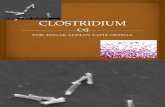 Clostridium Exposicion