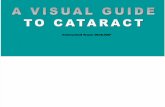 Visual Guide to Cataract
