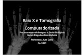 RaioXeTomografiaComputadorizada KCR