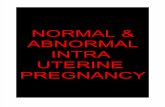 Usg Normal Pregnanacy