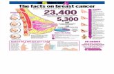 Infographic: Facts on Breast Cancer