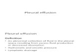 Pleural effusion3