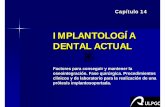 Implantología Dental