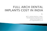 Full arch dental implants cost in india