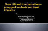 Sinus lift and its alternatives-pterygoid implants and basal implants