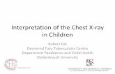 Link to PowerPoint presentation on Interpretation of the Chest X-Ray ...