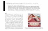 Prosthodontic guidelines for surgical reconstruction of the maxilla: A ...