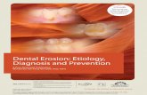 Dental Erosion: Etiology, Diagnosis and Prevention