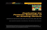 Duplicating the Posterior Extension of an Existing Denture