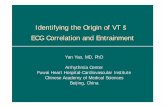 Identifying the Origin of VT ： ECG Correlation and Entrainment