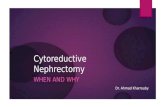 Cytoreductive nephrectomy (when and why)