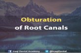Obturation of Root Canal - Brief Presentation