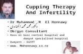 Infertility and cupping