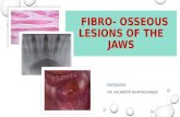 Fibroosseous lesions