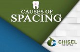 Causes of Spacing
