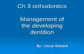 Ch3 Orthodontics  "management of developing dentition