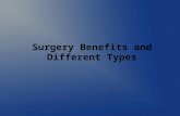Surgery benefits and different types