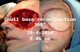 Skull base recontruction 360°
