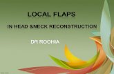 Local flaps in head & neack reconstruction