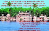 ROLE OF MRI AND MRS IN RING ENJANCING LESIONS OF BRAIN