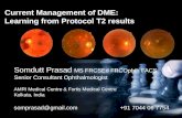 Dr Somdutt Prasad on Current Management of DME: Learning from Protocol T2 Results