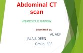 Abdominal CT scan