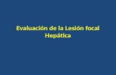 Evaluación de la Lesion focal hepatica