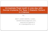Immediate fixed tooth in one day with dental implants