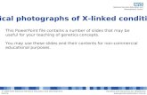 Clinical Photos: X-linked conditions