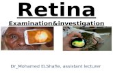 Retina. examination&investigation