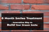 6 Month Smiles Treatment – Innovative Way to Build Your Dream Smile