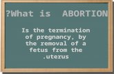 Abortion - Pro-life vs Pro-choice