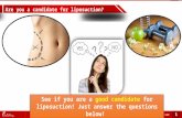 Survey: Are you a candidate for liposuction?