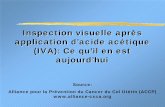 Inspection visuelle après application d'acide acétique (IVA): Ce qu'il ...