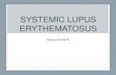 Systemic Lupus Erythematosus by Dr. Daniel B. Yidana