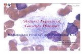 Skeletal Aspects of Gaucher Disease: Radiological Findings and ...