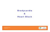 Bradycardia & Heart Block