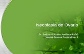 Neoplasia de ovario