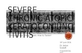 Severe chronic atopic keratoconjunctivitis