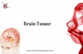 Brain Tumor Treatment In Chennai | Brain Tumor Surgery  In India