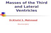 Third ventricular-masses