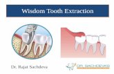 Wisdom tooth removal in delhi