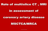 Role of MDCT MULTISCLICE CT tin coronary artery part 4 (anomalous coronary arteries) Dr Ahmed Esawy