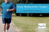 Total Knee Replacement Surgery - Pain-Free Knee Mobility
