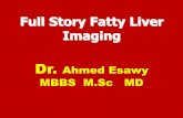 Full story fatty liver imaging Dr Ahmed Esawy