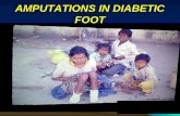 1362462786 amputation in diabetic foot