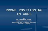 Prone Positioning in ARDS By Dr Muhammad Akram Khan Qaim KHani